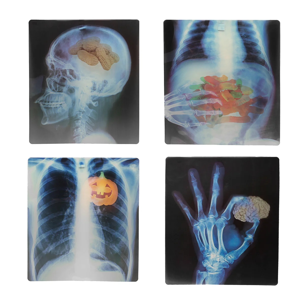 Funny Medical Xray Images Set of 4 Halloween Window Decor Human Skeleton Decal